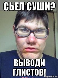 сьел суши? выводи глистов!