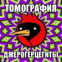 томография джерогерцегиты