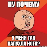 ну почему у меня так напухла нога?