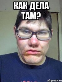 как дела там? 