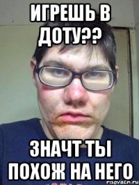 игрешь в доту?? значт ты похож на него