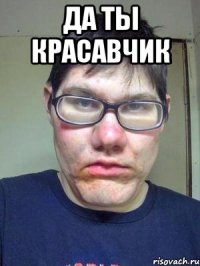 да ты красавчик 