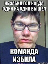 не забил гол когда один на один вышел команда избила
