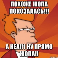 похоже жопа покозалась!!! а неа!!1 ну прямо жопа!!