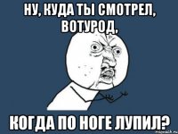 ну, куда ты смотрел, вотурод, когда по ноге лупил?