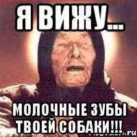 я вижу... молочные зубы твоей собаки!!!