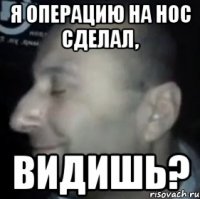 я операцию на нос сделал, видишь?