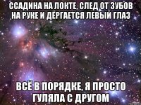 ссадина на локте, след от зубов на руке и дёргается левый глаз всё в порядке, я просто гуляла с другом