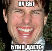 ну вы блин даете