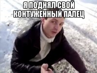 я поднял свой контуженный палец 