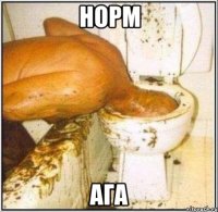 норм ага