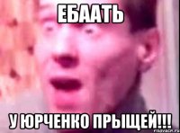 ебаать у юрченко прыщей!!!