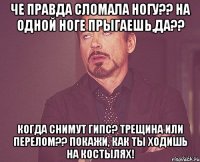 че правда сломала ногу?? на одной ноге прыгаешь,да?? когда снимут гипс? трещина или перелом?? покажи, как ты ходишь на костылях!