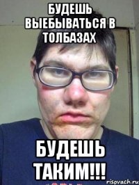 будешь выебываться в толбазах будешь таким!!!