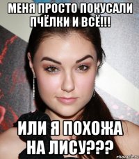 меня просто покусали пчёлки и всё!!! или я похожа на лису???