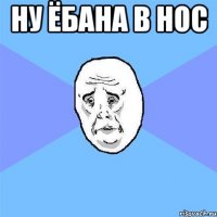 ну ёбана в нос 