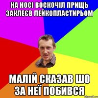 на носі воскочіл прищь заклеєв лейкопластирьом малій сказав шо за неї побився