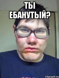 ты ебанутый? 