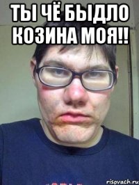 Ты чё быдло Козина моя!! 