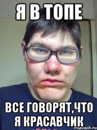 Я в ТОПе все говорят,что я красавчик