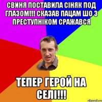 СВИНЯ ПОСТАВИЛА СіНЯК ПОД ГЛАЗОМ!!! СКАЗАВ ПАЦАМ ШО З ПРЕСТУПНІКОМ СРАЖАВСЯ ТЕПЕР ГЕРОЙ НА СЕЛІ!!!