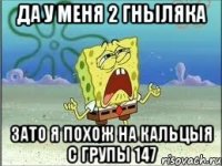 да у меня 2 гныляка зато я похож на Кальцыя с групы 147