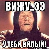 Вижу..ЭЭ У тебя вялый!