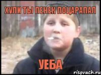 Хули ты пенек поцарапал Уеба