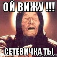 ОЙ ВИЖУ !!! СЕТЕВИЧКА ТЫ