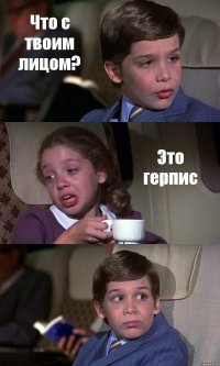 Что с твоим лицом? Это герпис 