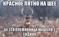 красное пятно на шее ах это племянница Машуля 2 годика