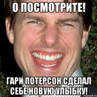 О посмотрите! Гари Потерсон сделал себе новую улыбку!