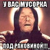 У вас мусорка ПОД РАКОВИНОЙ!!!