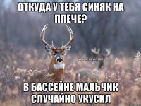 Откуда у тебя синяк на плече? В бассейне мальчик случайно укусил