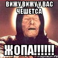 вижу вижу у вас чешетса ЖОПА!!!!!!