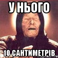 у нього 10 сантиметрів