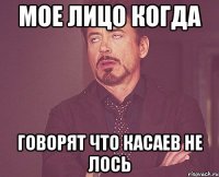 Мое лицо когда Говорят что касаев не лось