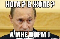 Нога ? В Жопе ? А мне норм )