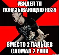 увидел тп показывающую козу вместо 2 пальцев сломал 2 руки