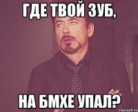 Где твой зуб, на БМХе упал?