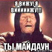 я вижу! я Вииииижу!!! ты майдаун