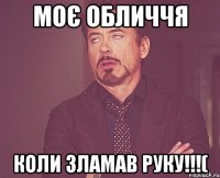 моє обличчя коли зламав руку!!!(