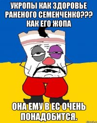 Укропы как здоровье раненого семенченко??? Как его жопа Она ему в ес очень понадобится.