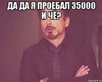 Да да я проебал 35000 и чё? 