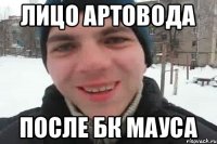 Лицо артовода После БК Мауса