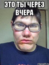 это ты через вчера 