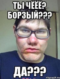 ты чёёё? борзый??? да???