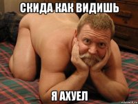 скида как видишь я ахуел