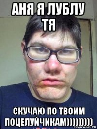 аня я лублу тя скучаю по твоим поцелуйчикам)))))))))