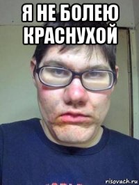 я не болею краснухой 